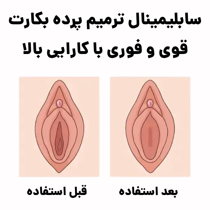 سابلیمینال ترمیم پرده بکارت